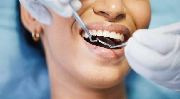 Best Broken or Chipped Tooth Repair in Hardwick, GA